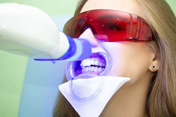 Laser teeth whitening treatments Leicester