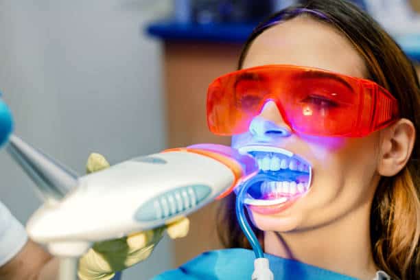 Simplifying Teeth Whitening: A Comprehensive Guide Leicester