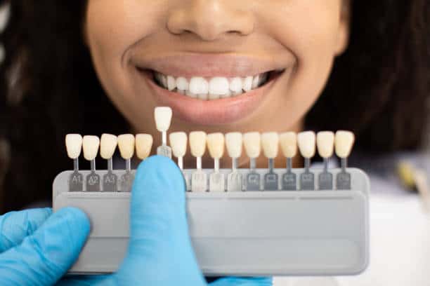 Laser Teeth Whitening: Exploring the Longevity of Your Brighter Smile Leicester