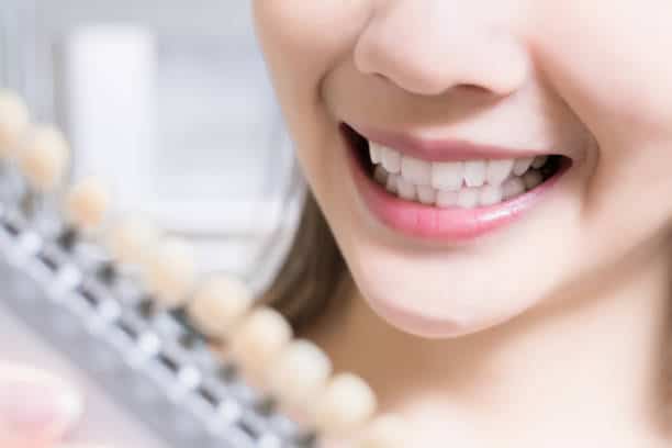 Teeth Whitening Kings Norton Leicester