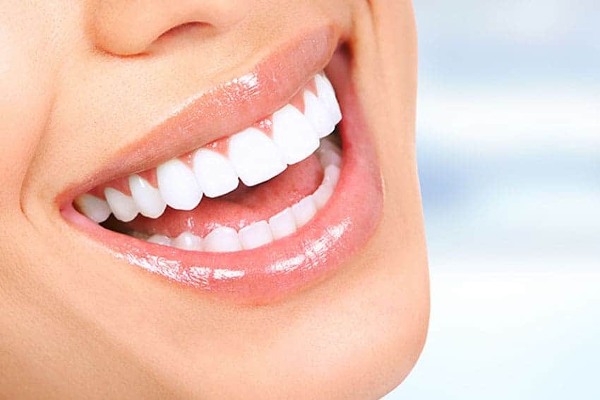 Teeth Whitening Abingdon Leicester