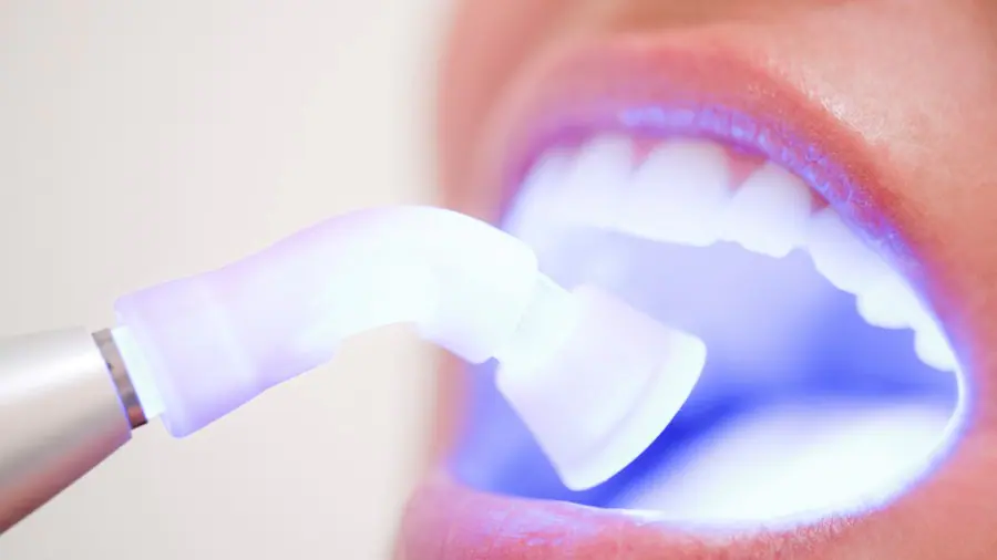 Teeth Whitening Aylesbury Leicester